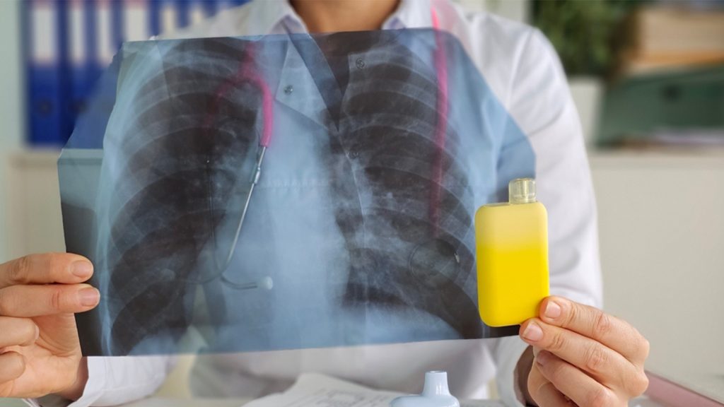 Gençlerde e-sigara alarmı, akciğer hasar alabilir!